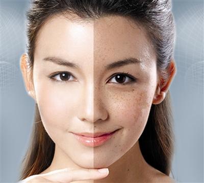 
色斑的那点事儿~~